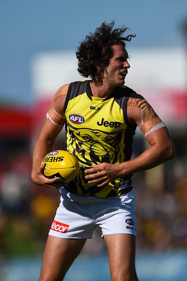 AFL 2016 NAB Challenge - Fremantle v Richmond The source of Ty Vickery's concussion was a mystery early on Friday evening - ${keywords}